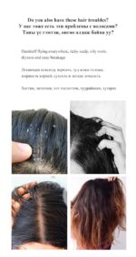 LIMANCY Sulfur Shampoo - Image 6